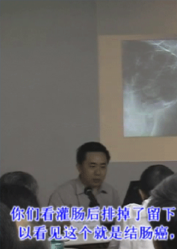 θ����������������������ص�ͷ�����ת�ƶԲ�